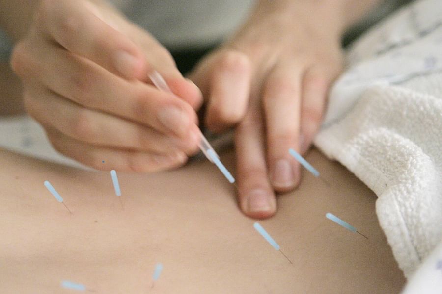 Archives of Internal Medicine acupuncture study 2012