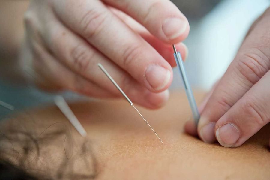 Journal of Alternative and Complementary Medicine acupuncture study 2013