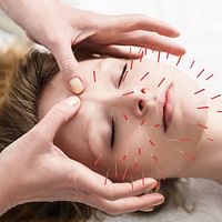 Facial Acupuncture: What It Is and How It Works