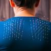 Understanding the Differences Between Dry Needling and Acupuncture