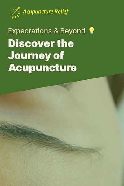 Discover the Journey of Acupuncture - Expectations & Beyond 💡