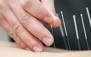 Can acupuncture be used for pain management?