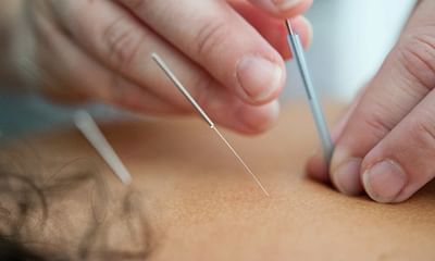 Can acupuncture provide healing?