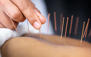 Does acupuncture help with various health conditions?