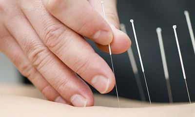 Does placing a needle on an acupuncture point direct qi to that area?