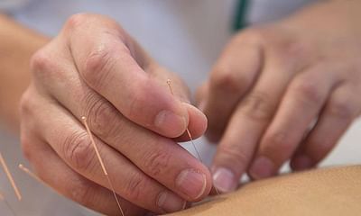 How can I begin a career in acupuncture?