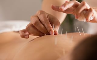How can I find a reputable acupuncturist?