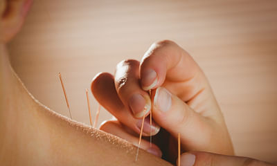 How does acupuncture healing work?