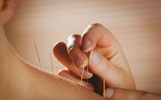 How effective is acupuncture for back pain?