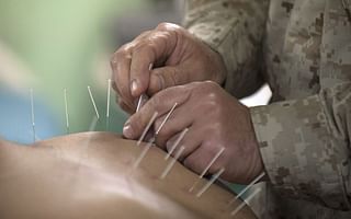 How many acupuncture treatments are needed and how often?