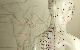 How should I prepare for acupuncture treatment?