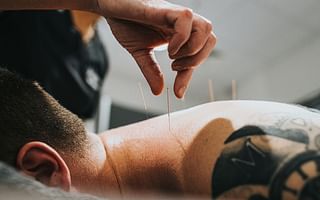 How to evaluate an acupuncturist?