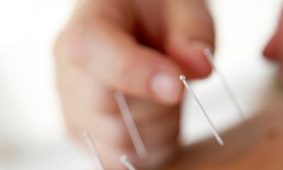 Is acupuncture a medically approved treatment?
