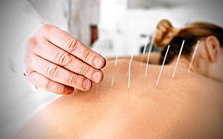 Is acupuncture supposed to be painful?