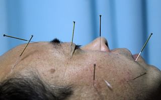 Is Chinese acupuncture theory supported by scientific evidence?