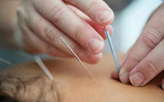 What are the acupuncture points for weight loss?