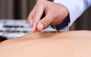 What are the benefits of acupuncture and how often should I receive treatment?