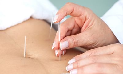 What are the risks and discomforts of acupuncture?