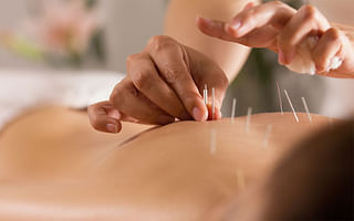 What is acupuncture and how does it work?