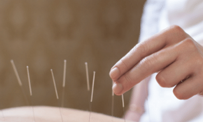 What is the cost of acupuncture if I pay in cash?