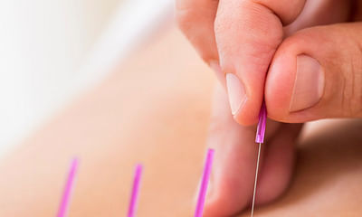 What is the opinion of physical therapists on acupuncture as a treatment?
