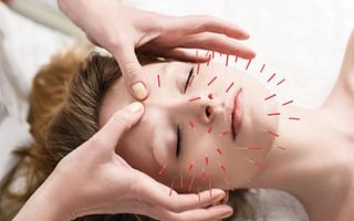 What is the origin of acupressure and acupuncture?