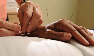 What kind of needles are used in acupuncture?