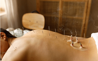 What qualities make a good acupuncturist?