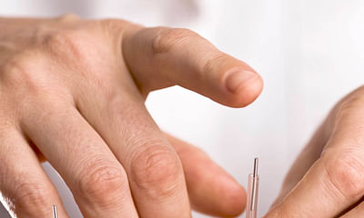 What should I expect during my first acupuncture consultation and treatment?