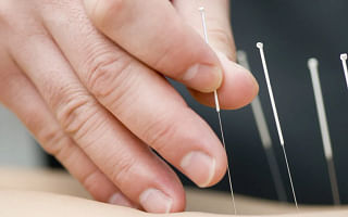 Why do people believe in acupuncture?